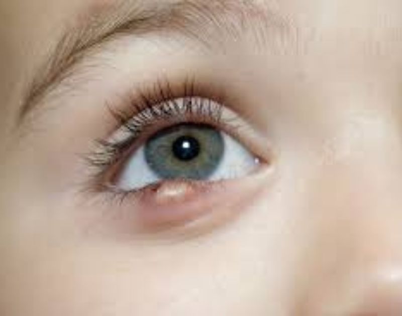 Bump or Lump on Eyelid