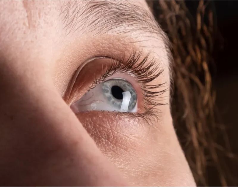 C3R – Keratoconus