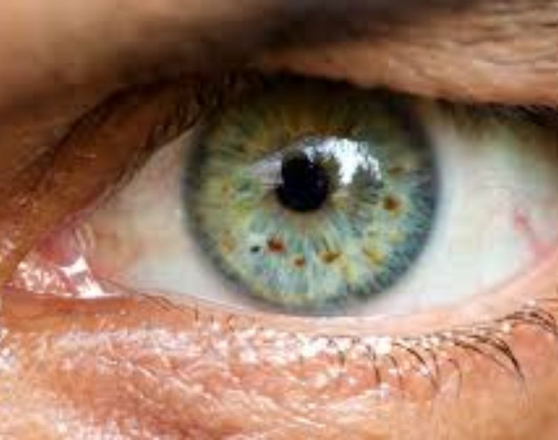 Dark Spots in Vision