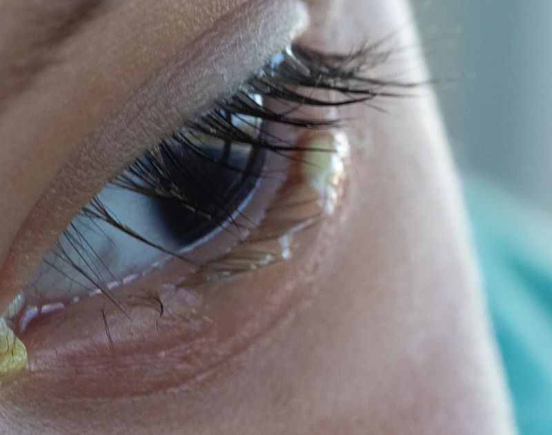 Discharge from Eye